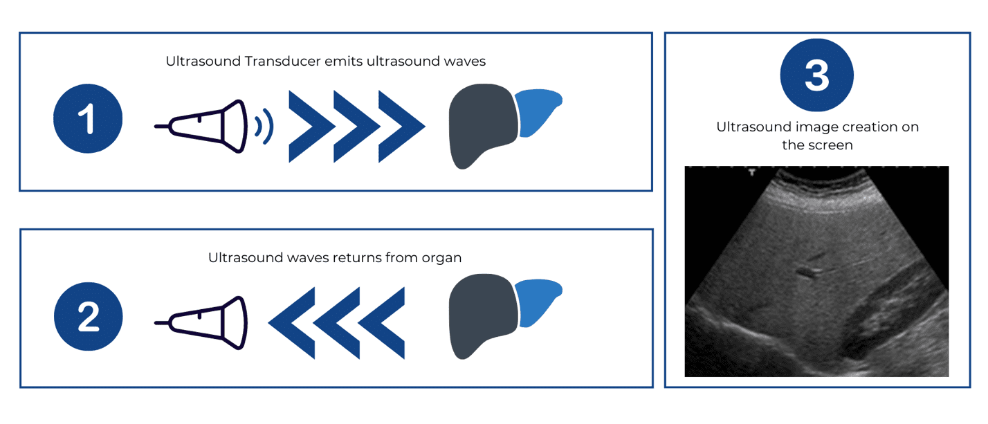Diagnostic Ultrasound